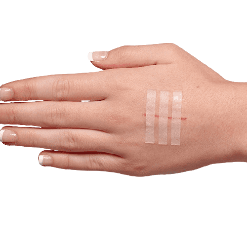 Wound Closure Strips 3 x 75mm Box/50