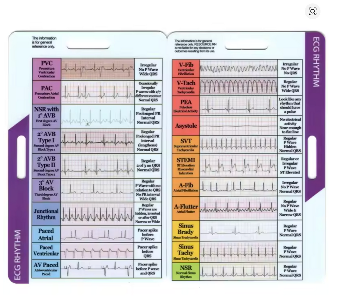 ECG Rhythm Pocket Interpretation Card